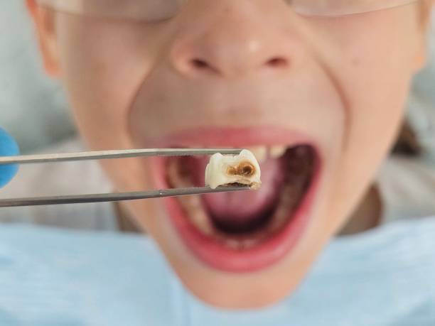 Best Emergency Dental Care for Trauma or Injury in Richwood, OH